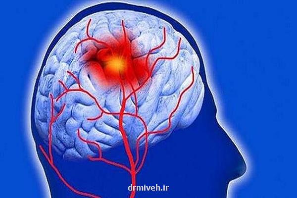 افزایش نرخ سکته مغزی در میان جوانان